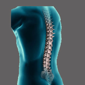 Posterior Longitudinal Ligament Ossification