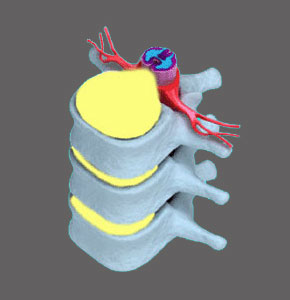 Acquired Spinal Stenosis