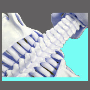 Causes of Cervical Spinal Stenosis