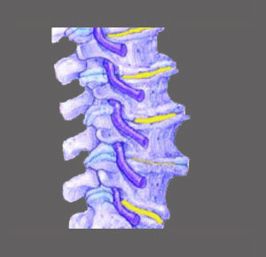 Causes of Foraminal Stenosis