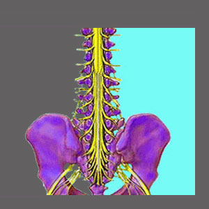 Foraminal Stenosis Treatment