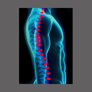 Help for Spinal Stenosis