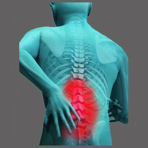 Living with Spinal Stenosis