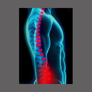 Lumbar Spinal Stenosis Symptoms