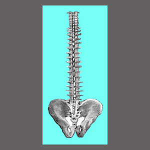 Misdiagnosed Spinal Stenosis