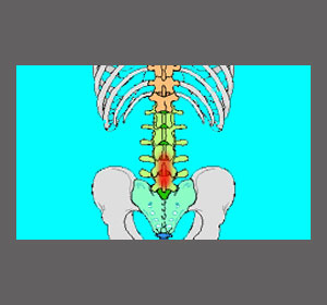 Paralyzed by Spinal Stenosis