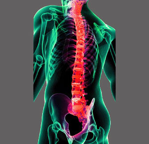 Spinal Stenosis Advice