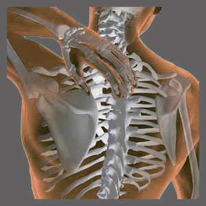 Spinal Stenosis in the Middle Back