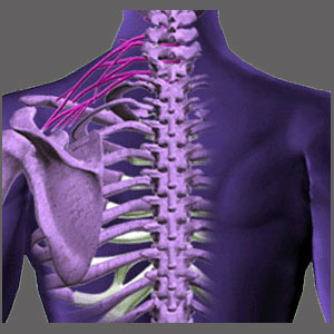 Spinal Stenosis in the Upper Back