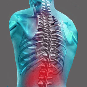 Spinal Stenosis Lower Back Pain