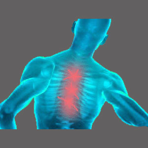 Spinal Stenosis Middle Back Pain