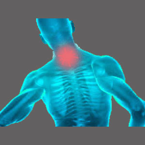 Spinal Stenosis Neck Pain