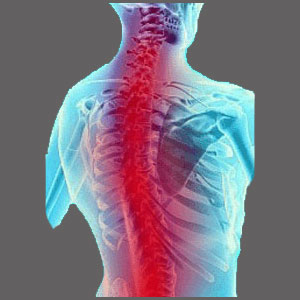 Spinal Stenosis Pain