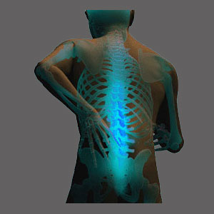 Spinal Stenosis Relief