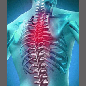 Spinal Stenosis Upper Back Pain