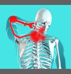 Symptoms of Foraminal Stenosis