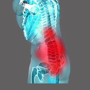 Symptoms of Spinal Stenosis