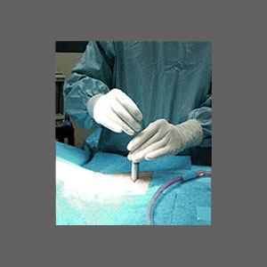 nerve block for spinal stenosis