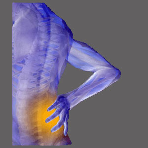 Combined care for spinal stenosis