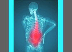 spinal stenosis pain